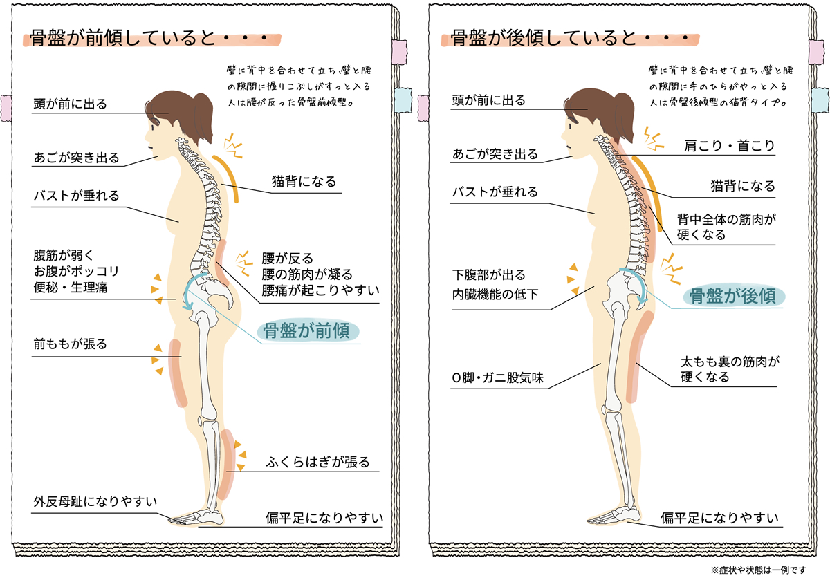 肥後橋のゆう整骨院の骨盤矯正(美容股関節矯正)