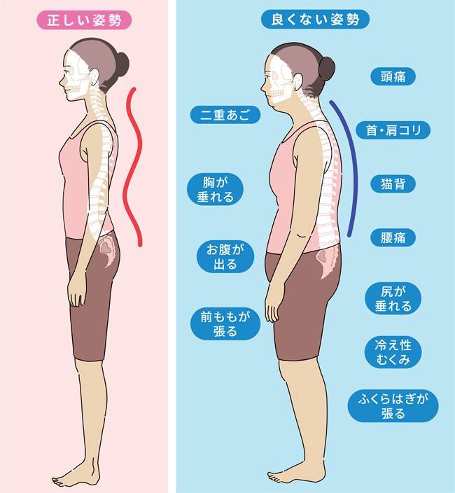 肥後橋のゆう整骨院の骨盤矯正・いい姿勢と悪い姿勢